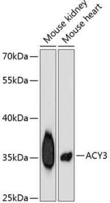 Western Blot: ACY3 Antibody [NBP2-92453] - Analysis of extracts of various cell lines, using ACY3 at 1:3000 dilution.Secondary antibody: HRP Goat Anti-Rabbit IgG (H+L) at 1:10000 dilution.Lysates/proteins: 25ug per lane.Blocking buffer: 3% nonfat dry milk in TBST.Detection: ECL Basic Kit .Exposure time: 90s.