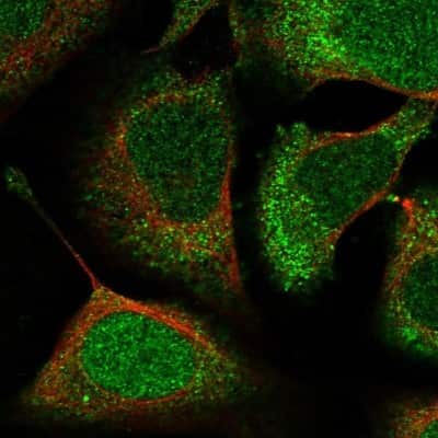 Immunocytochemistry/Immunofluorescence: ACYP1 Antibody [NBP1-86314] - Staining of human cell line U-2 OS shows localization to nucleus & cytosol. Antibody staining is shown in green.