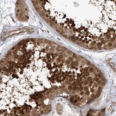 Immunohistochemistry-Paraffin: ACYP1 Antibody [NBP1-86314] - Staining of human testis shows strong cytoplasmic and nuclear positivity in cells of seminiferus ducts.