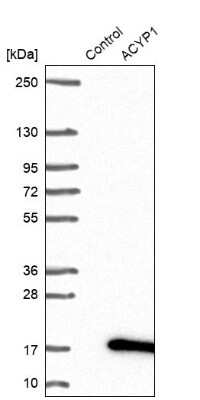 Western Blot ACYP1 Antibody - BSA Free