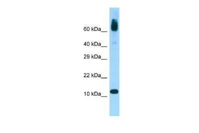Western Blot: ACYP1 Antibody [NBP2-86953] - WB Suggested Anti-ACYP1 Antibody. Titration: 1.0 ug/ml. Positive Control: Fetal Heart