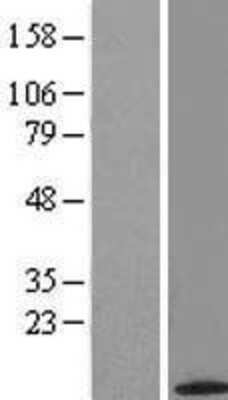 Western Blot: ACYP2 Overexpression Lysate (Adult Normal) [NBL1-07303] Left-Empty vector transfected control cell lysate (HEK293 cell lysate); Right -Over-expression Lysate for ACYP2.