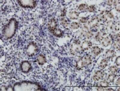 Immunohistochemistry-Paraffin: ADA2 beta Antibody (1C8) [H00093624-M08] - Analysis of monoclonal antibody to MGC21874 on formalin-fixed paraffin-embedded human stomach. Antibody concentration 1.5 ug/ml