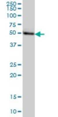 Western Blot: ADA2 beta Antibody (1C8) [H00093624-M08] - Analysis of MGC21874 expression in HeLa (Cat # L013V1).