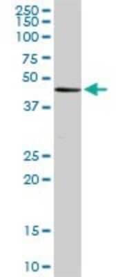 Western Blot: ADA2 beta Antibody (1C8) [H00093624-M08] - Analysis of MGC21874 expression in Raw 264.7 (Cat # L024V1).