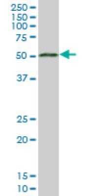 Western Blot ADA2 beta Antibody (3F3) - Azide and BSA Free