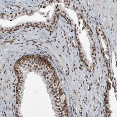 Immunohistochemistry: ADA2 beta Antibody [NBP1-91649] - Staining of human prostate shows strong nuclear positivity in glandular cells.