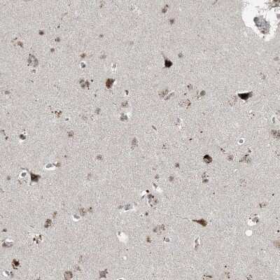 Immunohistochemistry-Paraffin: ADA2 beta Antibody [NBP1-91649] - Staining of human cerebral cortex shows strong nuclear positivity in neurons.