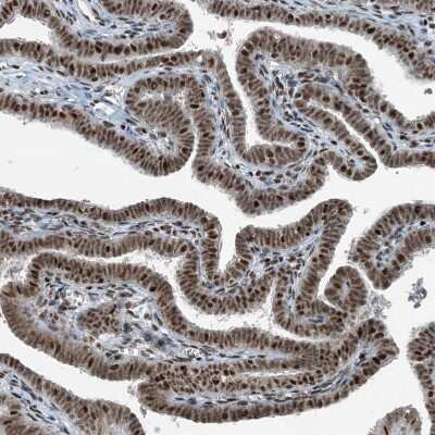 Immunohistochemistry-Paraffin: ADA2 beta Antibody [NBP1-91649] - Staining of human Fallopian tube shows strong nuclear positivity in glandular cells.