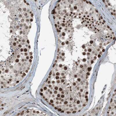 Immunohistochemistry-Paraffin: ADA2 beta Antibody [NBP1-91649] - Staining of human testis shows strong nuclear positivity in cells in seminiferous ducts.