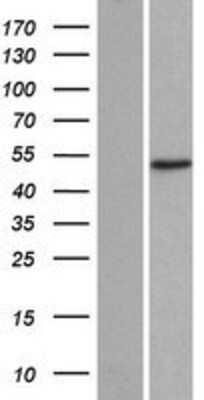 Western Blot ADA2 beta Overexpression Lysate