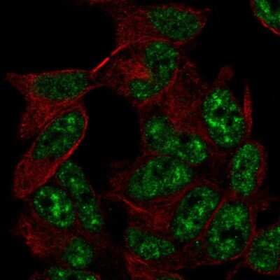 Immunocytochemistry/Immunofluorescence: ADA2a Antibody [NBP2-57507] - Staining of human cell line SH-SY5Y shows localization to nuclear speckles.