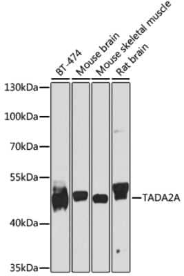 Western Blot: ADA2a Antibody [NBP2-92547] - Analysis of extracts of various cell lines, using ADA2a . Exposure time: 10s.