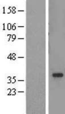 Western Blot: ADA2a Overexpression Lysate (Adult Normal) [NBL1-16676] Left-Empty vector transfected control cell lysate (HEK293 cell lysate); Right -Over-expression Lysate for ADA2a.