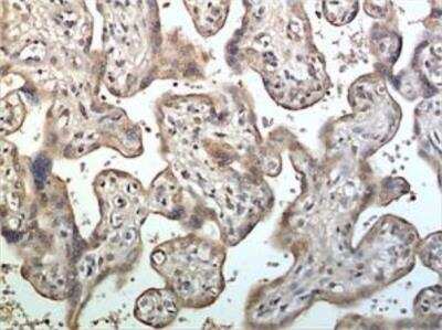 Immunohistochemistry-Paraffin: ADAM10 Antibody (6D39) [NBP2-36068] - A 10% Buffer formalin fixed and paraffin embedded human placental tissue section (4um) is subjected to IHC staining using a mouse anti-human ADAM-10 monoclonal antibody. Tissue section was pretreated in citric buffer (ph6.0) with microwave for antigen retrieval before IHC is applied.