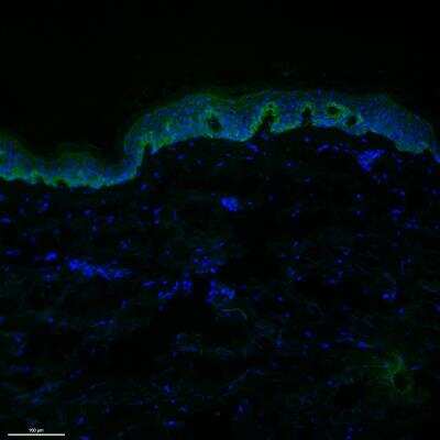 Immunohistochemistry-Frozen: ADAM10 Antibody - BSA Free [NBP1-76973] - ADAM10 (green) stained human skin, counterstained with DAPI. Tissue fixed, permeablized, and blocked with 5% BSA TBS Ca/Azide. Anti-ADAM10 antibody applied at 1:100, before washed and stained with Alexa488-conjugated secondary. Slides mounted with DAPI. Image from verified customer review.