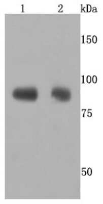 Western Blot: ADAM10 Antibody (JM32-11) [NBP2-67115] - Analysis of ADAM10 on different cells lysates using anti-ADAM10 antibody at 1/500 dilution. Positive control:Line 1: Jurkat Line 2: Hela