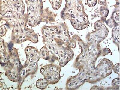 Immunohistochemistry-Paraffin: ADAM10 Antibody (MM0077-6D31) [NBP2-12014] - 10% Buffer formalin fixed and parffine embedded human placetal tissue section (4um) is subjected IHC staining using NBP2-12014. Tissue section was pretreated in citric buffer (pH 6.0) with microwave for antige retrieval before IHC is applied.  