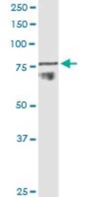 Western Blot: ADAM11 Antibody (3D4) [H00004185-M01] - ADAM11 monoclonal antibody (M01), clone 3D4. Analysis of ADAM11 expression in human colon.