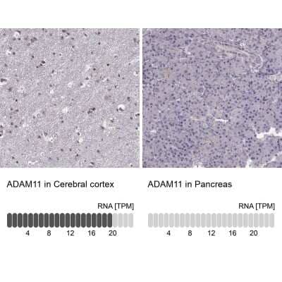 Immunohistochemistry-Paraffin: ADAM11 Antibody [NBP2-62689] - Analysis in human cerebral cortex and pancreas tissues using Anti-ADAM11 antibody. Corresponding ADAM11 RNA-seq data are presented for the same tissues.