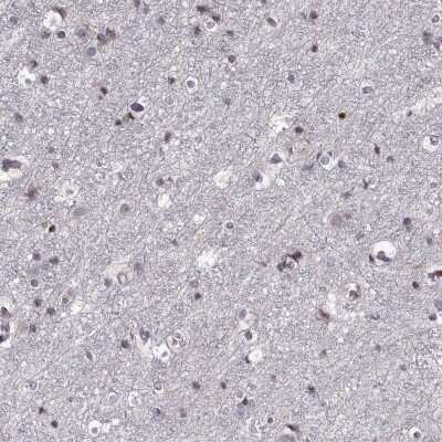 <b>Orthogonal Strategies Validation. </b>Immunohistochemistry-Paraffin: ADAM11 Antibody [NBP2-62689] - Staining of human cerebral cortex shows high expression.