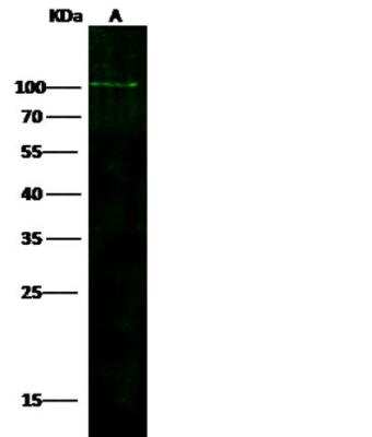 Western Blot: ADAM12 Antibody (737) [NBP2-89702] - Lane A: A431 Whole Cell Lysate Lysates/proteins at 30 ug per lane.Secondary Goat Anti-Rabbit IgG H&L (Dylight800) at 1/10000 dilution.Developed using the Odyssey technique.  Performed under reducing conditions.Predicted band size:100 kDa Observed band size:100 kDa