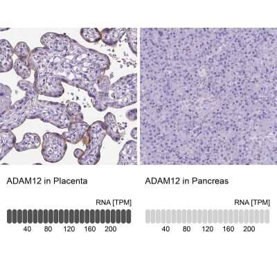 Immunohistochemistry-Paraffin: ADAM12 Antibody [NBP1-82791] - Staining in human placenta and pancreas tissues . Corresponding ADAM12 RNA-seq data are presented for the same tissues.