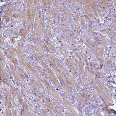 Immunohistochemistry-Paraffin: ADAM12 Antibody [NBP2-33939] - Staining of human smooth muscles shows moderate positivity.