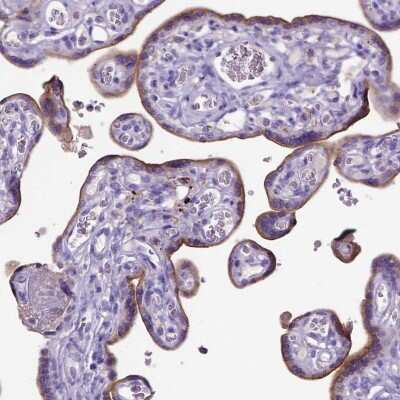 Immunohistochemistry-Paraffin: ADAM12 Antibody [NBP2-33940] - Staining of human placenta shows moderate positivity in trophoblastic cells.