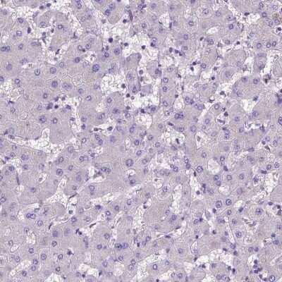 Immunohistochemistry-Paraffin: ADAM12 Antibody [NBP2-33940] - Staining of human liver shows no positivity in hepatocytes as expected.