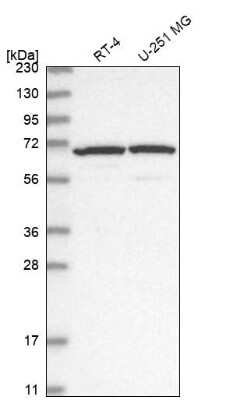 <b>Orthogonal Strategies Validation. </b>Western Blot: ADAM12 Antibody [NBP2-33940] - Analysis in human cell line RT-4 and human cell line U-251 MG.