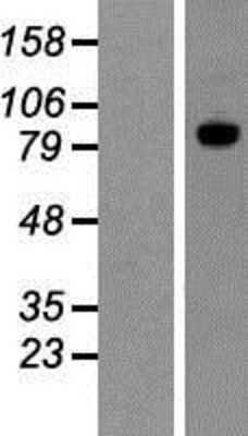 Western Blot ADAM15 Overexpression Lysate