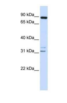 Western Blot: ADAM19 Antibody [NBP1-69367] - This Anti-ADAM19 antibody was used in Western Blot of 721_B tissue lysate at a concentration of 1ug/ml.