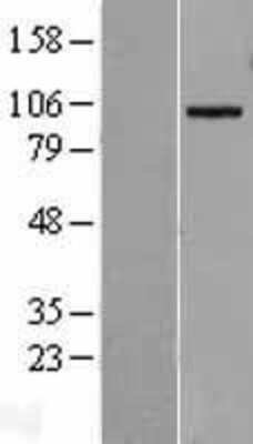 Western Blot: ADAM19 Overexpression Lysate (Adult Normal) [NBL1-07307] Left-Empty vector transfected control cell lysate (HEK293 cell lysate); Right -Over-expression Lysate for ADAM19.