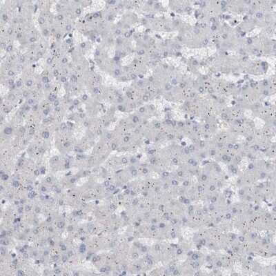 <b>Orthogonal Strategies Validation. </b>Immunohistochemistry-Paraffin: ADAM2 Antibody [NBP1-85415] - Staining of human liver shows low expression as expected.