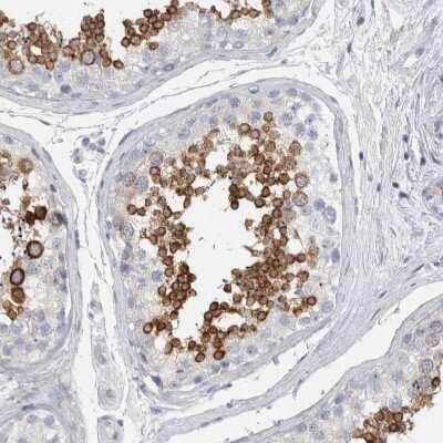 Immunohistochemistry-Paraffin: ADAM2 Antibody [NBP1-85415] - Staining of human testis shows high expression.