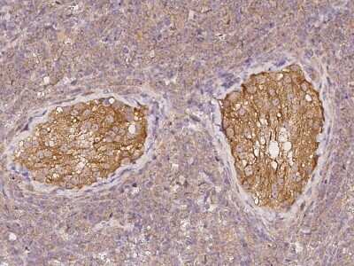Immunohistochemistry-Paraffin: ADAM20 Antibody [NBP2-98032] - Immunochemical staining of human ADAM20 in human testis with rabbit polyclonal antibody at 1:500 dilution, formalin-fixed paraffin embedded sections.