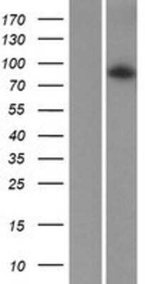 Western Blot: ADAM20 Overexpression Lysate (Adult Normal) [NBP2-07948] Left-Empty vector transfected control cell lysate (HEK293 cell lysate); Right -Over-expression Lysate for ADAM20.