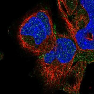 Immunocytochemistry/Immunofluorescence: ADAM22 Antibody [NBP2-58310] - Staining of human cell line HEK 293 shows localization to cell junctions.