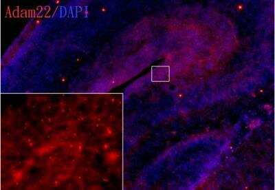 Immunohistochemistry-Frozen: ADAM22 Antibody [NBP2-15282] - ADAM22 antibody [N1N2] detects ADAM22 protein on embryonic mouse brain by immunohistochemical analysis. Sample: Frozen section of embryonic mouse brain (mE18.5). Red: ADAM22 antibody [N1N2] diluted at 1:500. Blue: DAPI