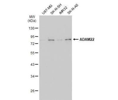 Western Blot: ADAM22 Antibody [NBP2-15282] - Various whole cell extracts (30 ug) were separated by 10% SDS-PAGE, and the membrane was blotted with ADAM22 antibody [N1N2], N-term  diluted at 1:500. The HRP-conjugated anti-rabbit IgG antibody (NBP2-19301) was used to detect the primary antibody.