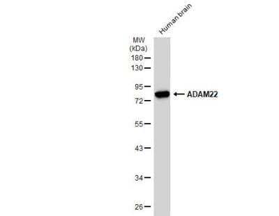 Western Blot: ADAM22 Antibody [NBP2-15282] - Human tissue extract (30 ug) was separated by 10% SDS-PAGE, and the membrane was blotted with ADAM22 antibody [N1N2], N-term diluted at 1:500. The HRP-conjugated anti-rabbit IgG antibody (NBP2-19301) was used to detect the primary antibody.