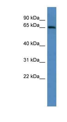 Western Blot: ADAM23 Antibody [NBP1-69016] - Mouse Heart lysate, concentration 0.2-1 ug/ml.