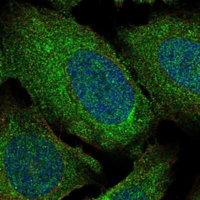 Immunocytochemistry/Immunofluorescence: ADAM28 Antibody [NBP2-55995] - Staining of human cell line U-2 OS shows localization to plasma membrane and mitochondria. Antibody staining is shown in green.