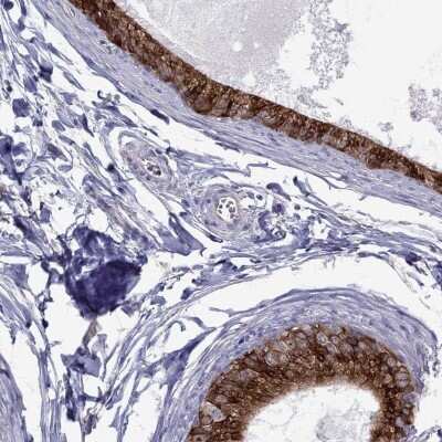 Immunohistochemistry-Paraffin: ADAM28 Antibody [NBP2-55995] - Staining of human epididymis shows high expression.