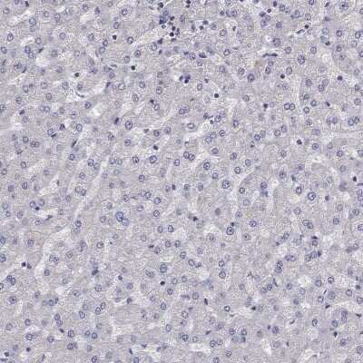 Immunohistochemistry-Paraffin: ADAM28 Antibody [NBP2-55995] - Staining of human liver shows low expression as expected.