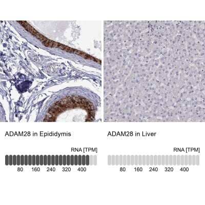 <b>Orthogonal Strategies Validation. </b>Immunohistochemistry-Paraffin: ADAM28 Antibody [NBP2-55995] - Staining in human epididymis and liver tissues using anti-ADAM28 antibody. Corresponding ADAM28 RNA-seq data are presented for the same tissues.