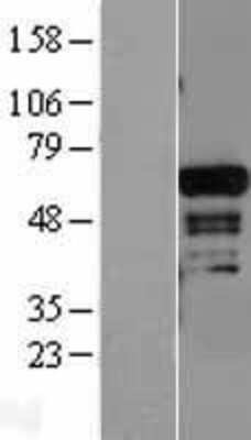 Western Blot: ADAM28 Overexpression Lysate (Adult Normal) [NBL1-07309] Left-Empty vector transfected control cell lysate (HEK293 cell lysate); Right -Over-expression Lysate for ADAM28.