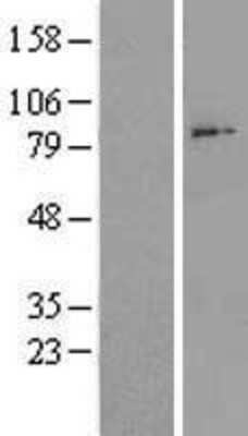 Western Blot: ADAM28 Overexpression Lysate (Adult Normal) [NBL1-07310] Left-Empty vector transfected control cell lysate (HEK293 cell lysate); Right -Over-expression Lysate for ADAM28.