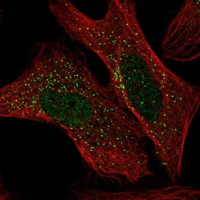 Immunocytochemistry/Immunofluorescence: ADAM32 Antibody [NBP2-55758] - Staining of human cell line U-2 OS shows localization to nucleus & vesicles.